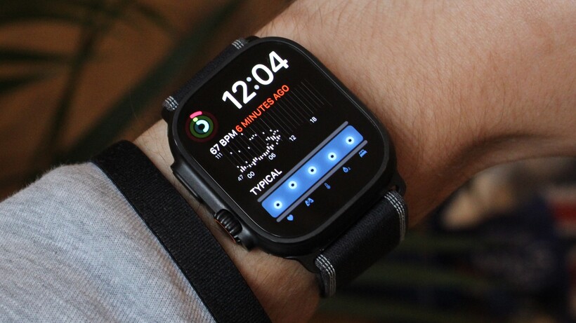 apple watch vitals watch face